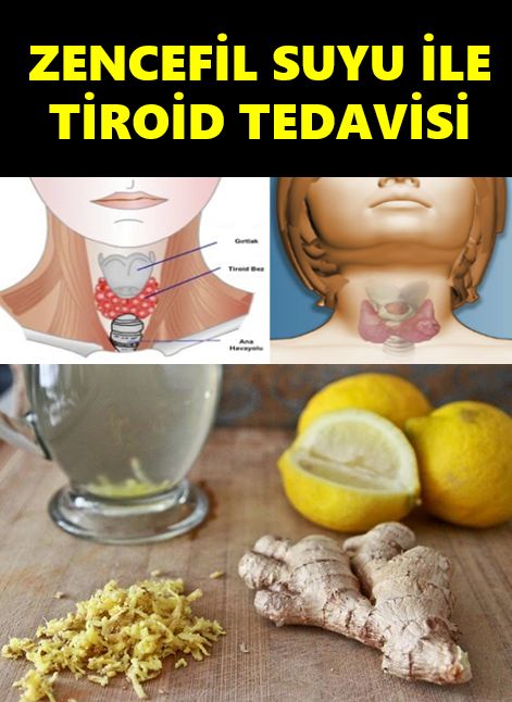 Zencefil Suyu İle Tİroid Hastalığına Çözüm