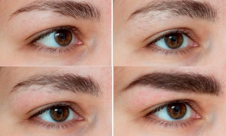 Kaş Gürleştirme ve Kaş Bakım Yöntemleri