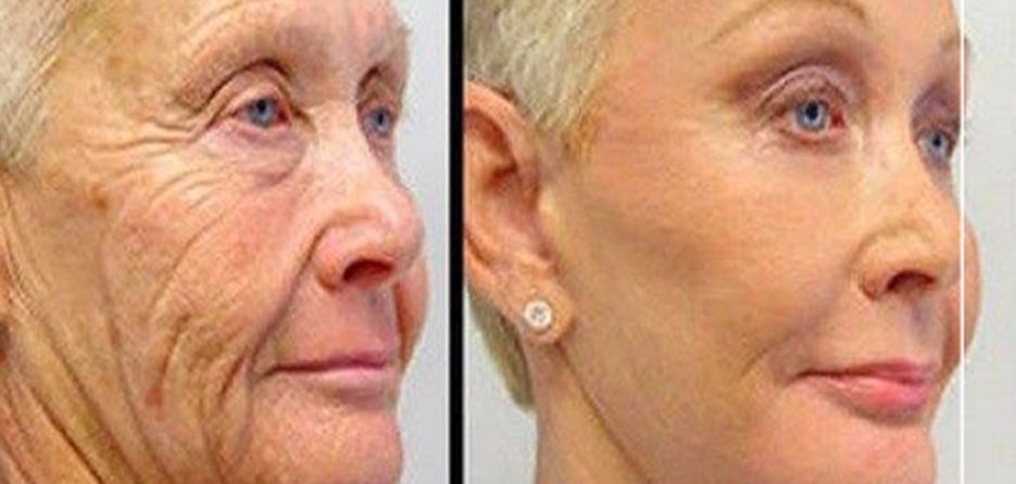 Her Sabah Yüzünüzü Bu 2 Malzemeli Karışımla Yıkayın