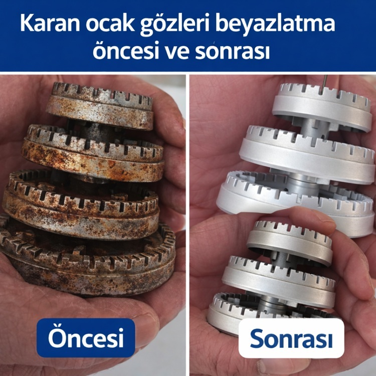 Karan Ocak Gözleri Beyazlatma