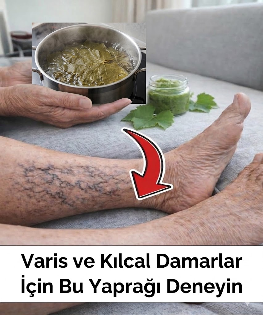 Varis ve Kılcal Damarlar İçin Doğal Kür